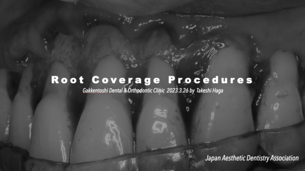 審美歯科協会で講演